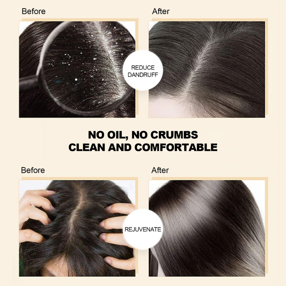SL Basics Ginger Oil & Shampoo Duo - Reduces Hair Fall, Dandruff & Makes Hair Thicker and Softer