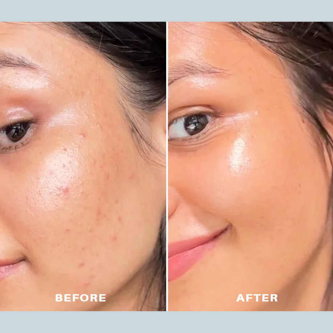 Rice & Ceramide Peel off Mask - Hydrated, Brightening, Clear & Glass Skin