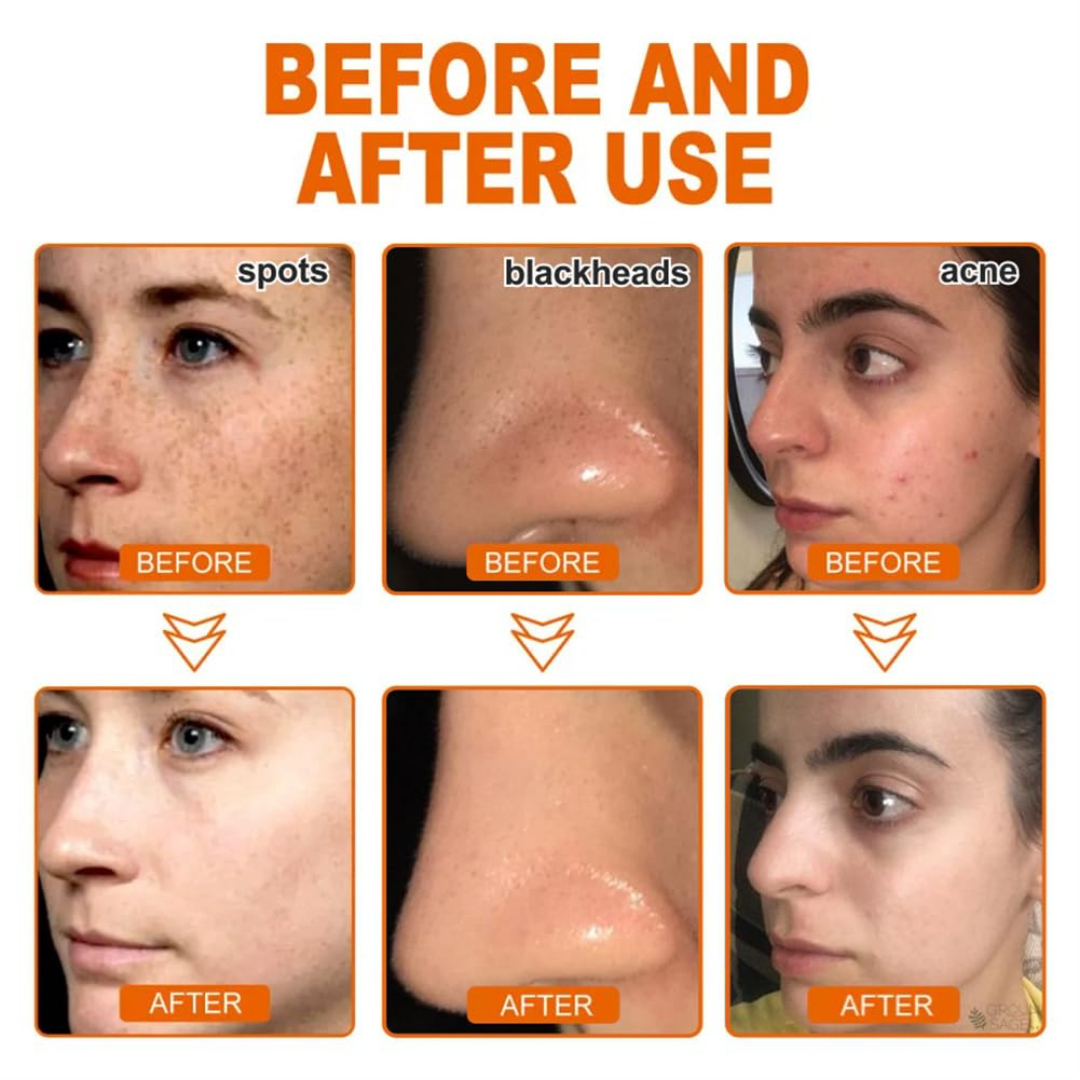 Rice & Ceramide Peel off Mask - Hydrated, Brightening, Clear & Glass Skin
