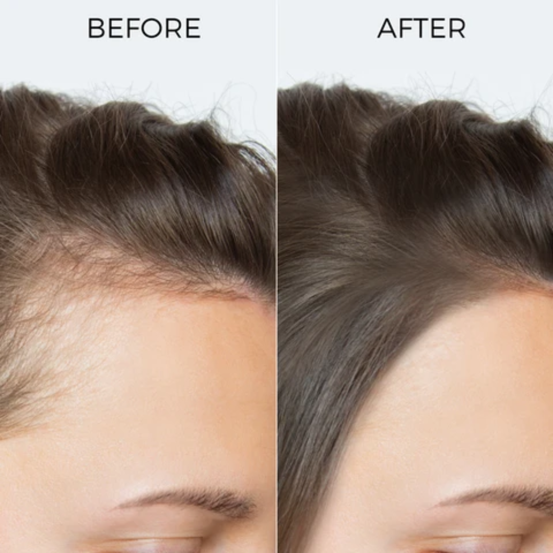 SL Basics Ginger Oil & Shampoo Duo - Reduces Hair Fall, Dandruff & Makes Hair Thicker and Softer