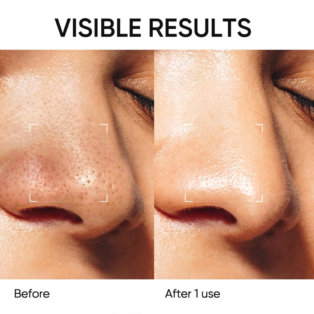 SKINTIFIC Alaska Volcano Pore Clay Stick | Glycolic Acid + Probiotic Complex + Collagen | Deep Blackhead Removal, Oil Control & Pore Tightening