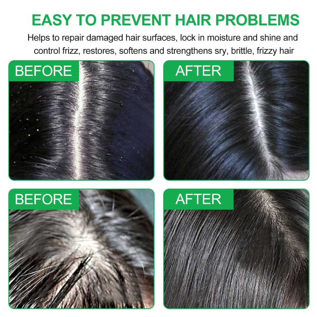 SL Basics Ginger Oil & Shampoo Duo - Reduces Hair Fall, Dandruff & Makes Hair Thicker and Softer