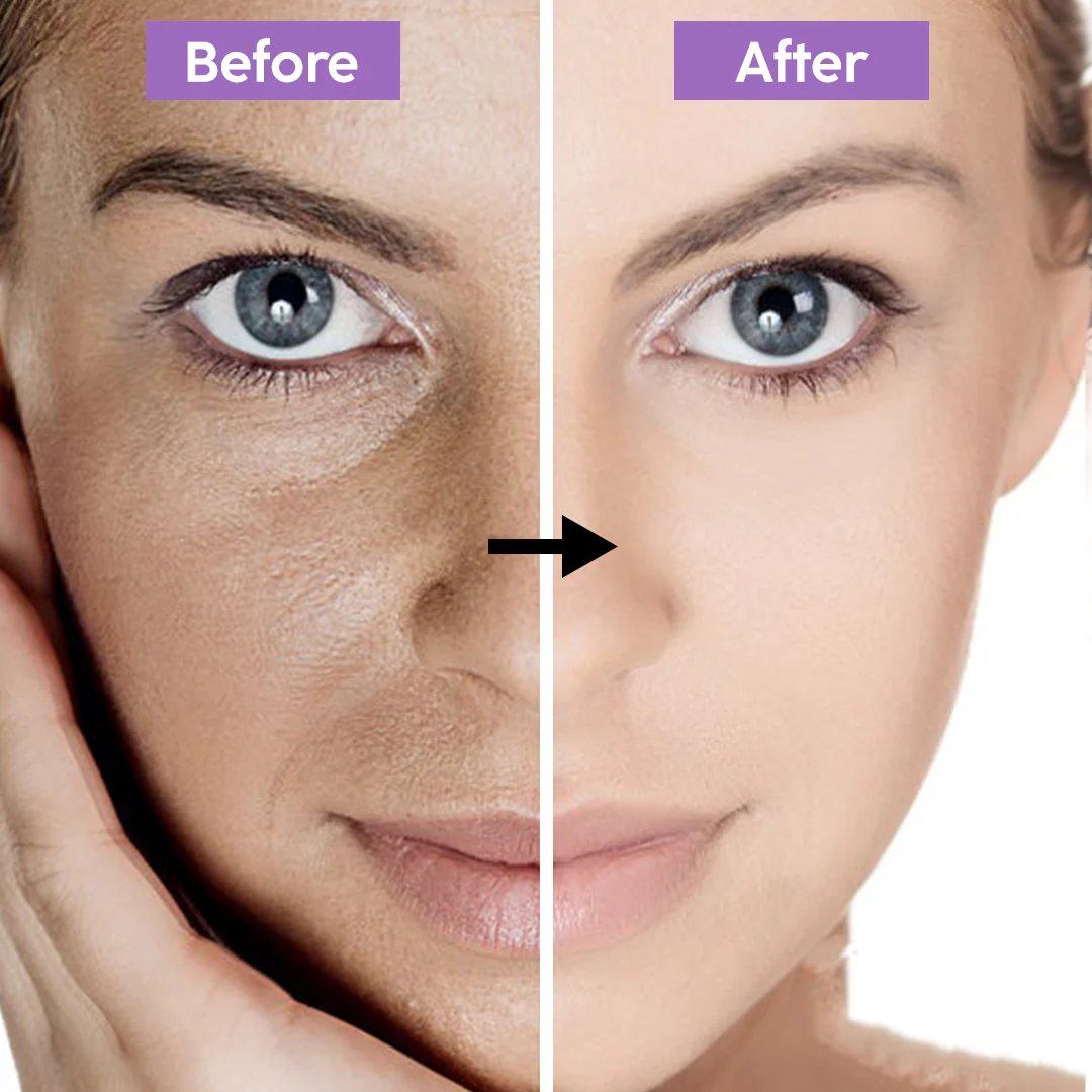 Deconstruct Clearing Serum - Remove Pigmentation & dark spots in just 7 days - Guaranteed Results